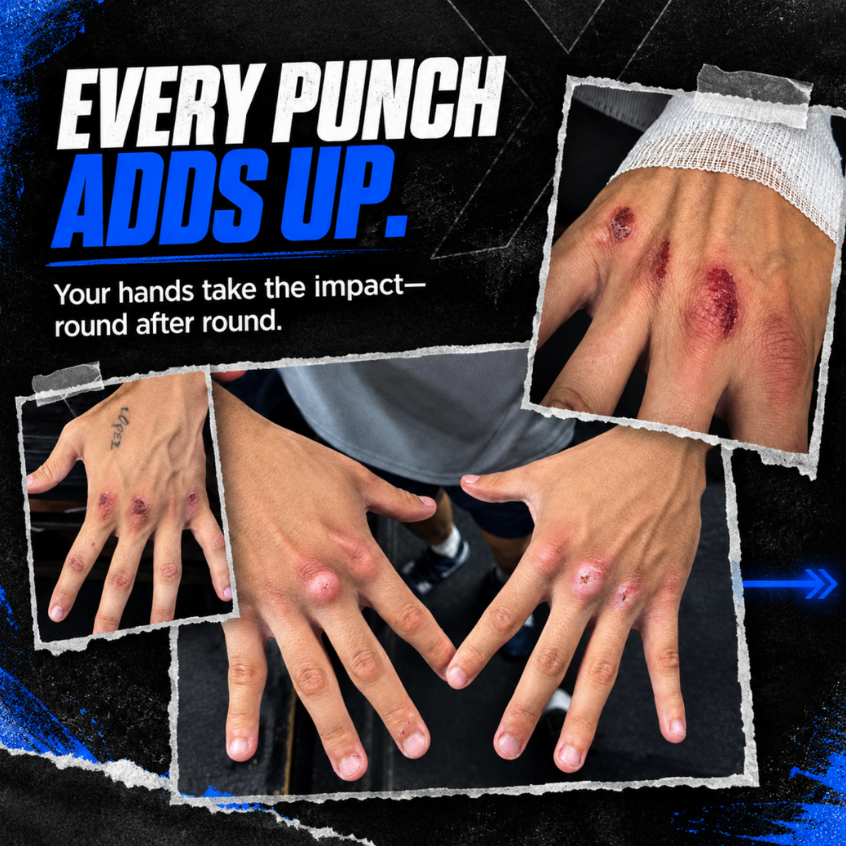 Promotional graphic showing multiple close-up views of a person's hands with red bruising and swelling after punches, with large text reading 'EVERY PUNCH ADDS UP.' on a dark graphic background. this is a boxers injured hand